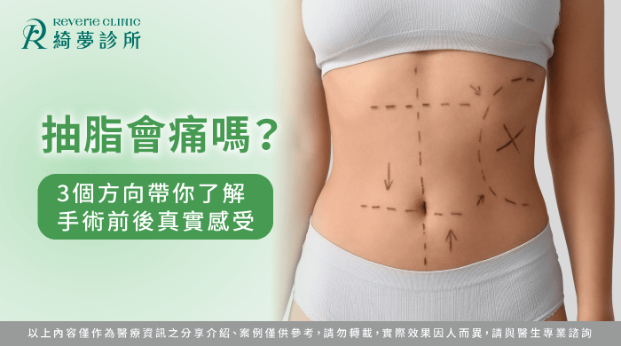 抽脂會痛嗎-抽脂 痛嗎