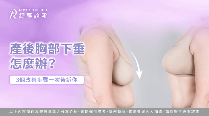 產後胸部下垂怎麼辦-產後胸部下垂