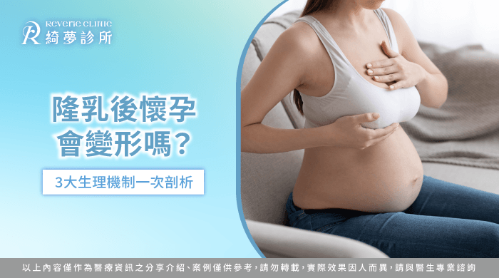 隆乳後懷孕會變形嗎解析-隆乳懷孕變形