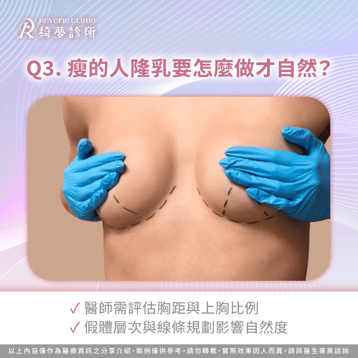 瘦的人隆乳怎麼做才自然?胸型比例與線條設計重點 瘦的人隆乳自然-隆乳適合瘦的人嗎