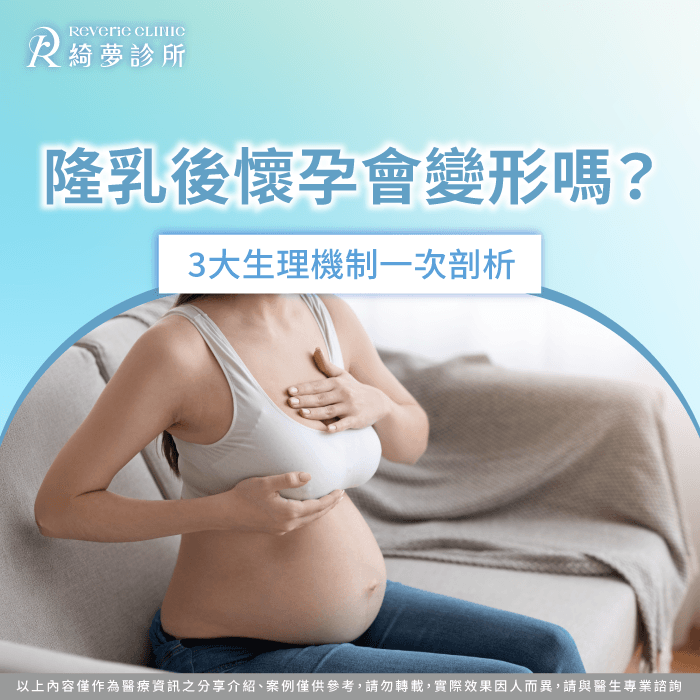 掌握假體物理特性與乳腺組織生理機制,解答隆乳後懷孕會變形嗎的疑問。 隆乳後懷孕會變形嗎解析-隆乳懷孕變形