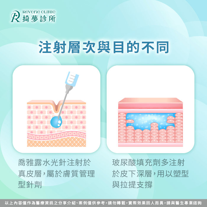 注射層次-喬雅露水光針與玻尿酸有什麼不同