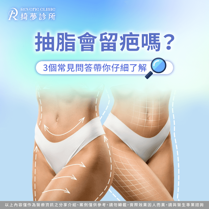 抽脂會留疤嗎-抽脂 留疤