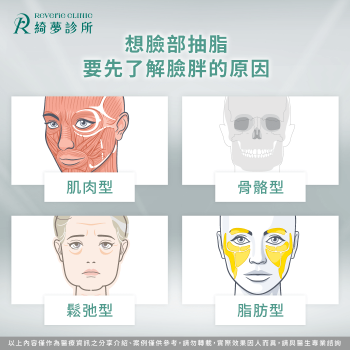 臉胖成因包含脂肪、肌肉與骨骼結構,並非所有狀況都適合抽脂 臉胖的原因-臉可以抽脂嗎
