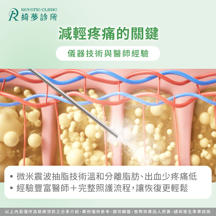 醫師推薦低疼痛、恢復快的抽脂技術 抽脂技術-抽脂會痛嗎