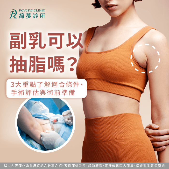 副乳可以抽脂嗎?3個關鍵了解組織判斷、手術方式與術前準備 副乳可以抽脂嗎-副乳抽脂