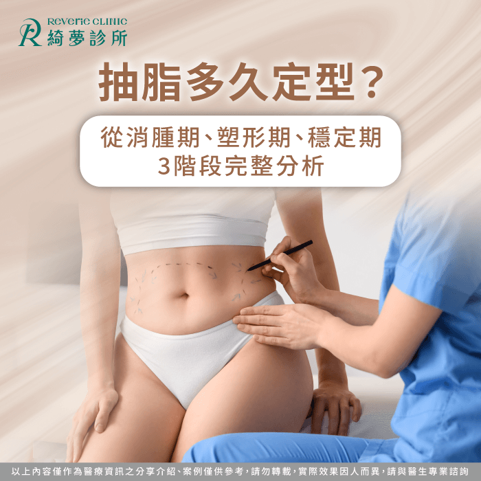 抽脂多久定型?3個階段看懂線條成形與成果穩定時間 抽脂多久定型-抽脂 定型