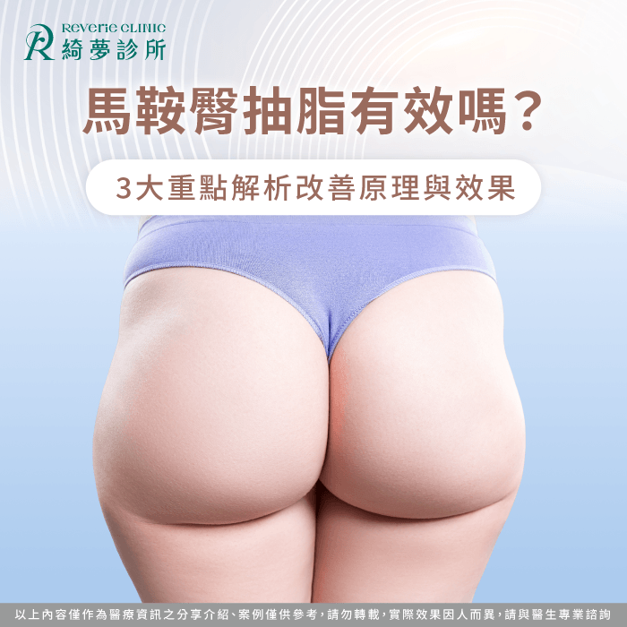 馬鞍臀 抽脂-馬鞍肉 抽脂