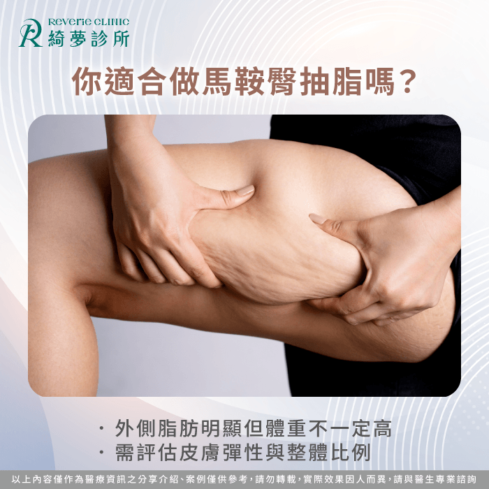 你適合做馬鞍臀抽脂嗎-馬鞍臀 抽脂