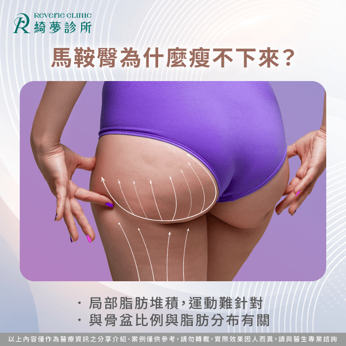 馬鞍臀難瘦原因-馬鞍臀 抽脂