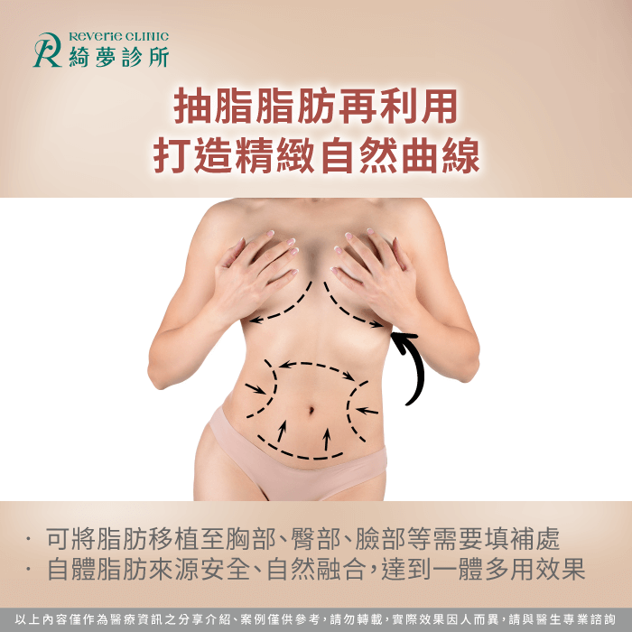 自體脂肪移植-抽脂優點