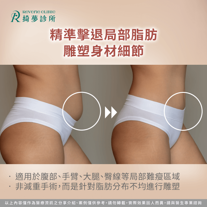 消除局部脂肪-抽脂有用嗎