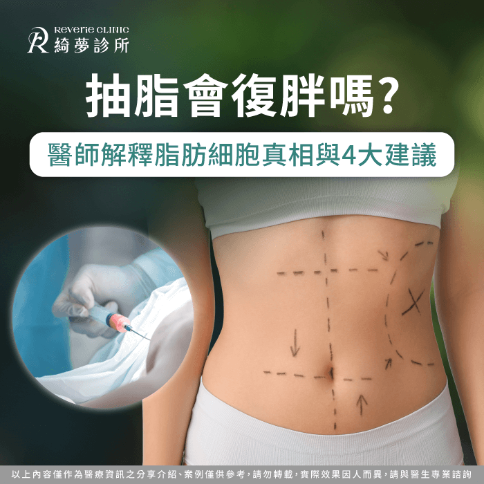 抽脂會復胖嗎-抽脂 復胖