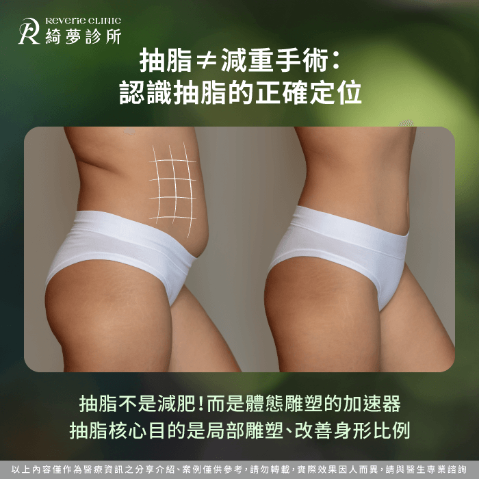 抽脂不等於減重-抽脂會復胖嗎