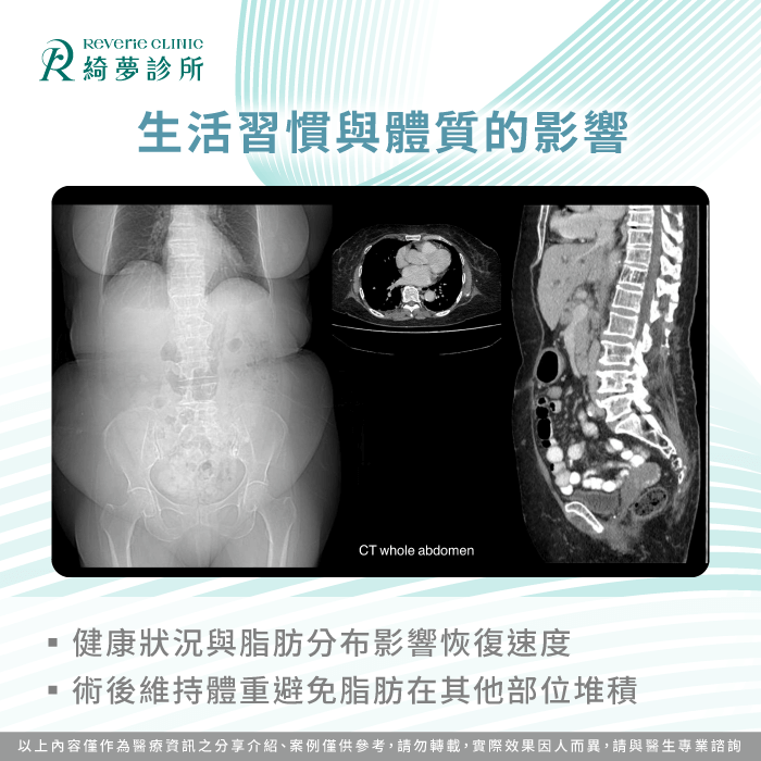 生活習慣與體質的影響-抽脂有副作用嗎