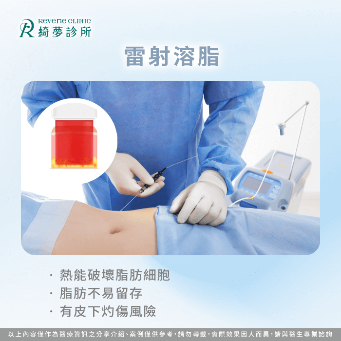 雷射溶脂-抽脂種類有哪些