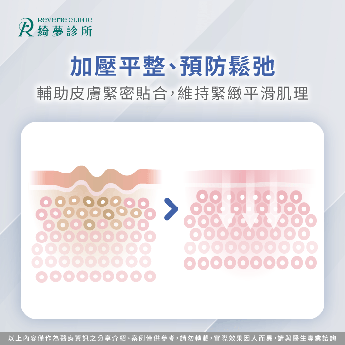適度加壓能輔助皮下組織緊密貼合並維持術後肌膚平整度 加壓平整肌理預防鬆弛-抽脂後一定要穿塑身衣嗎