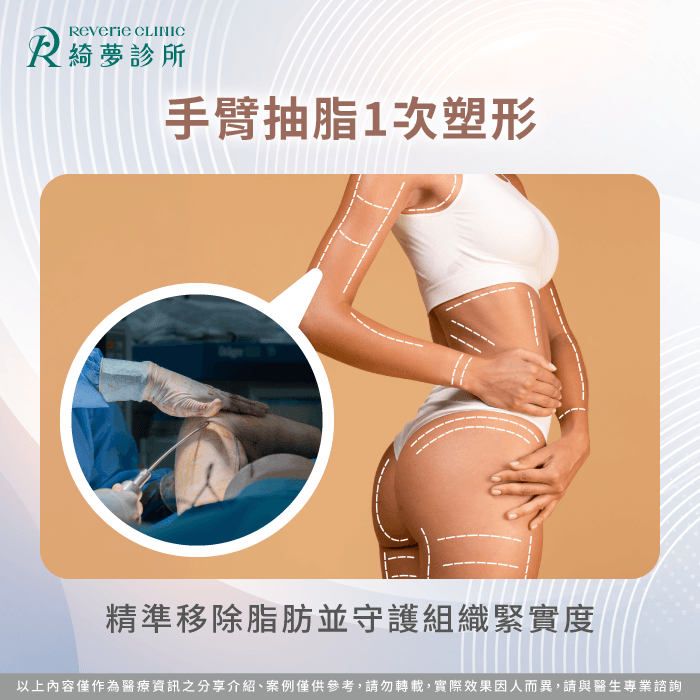 手臂抽脂手術極速塑形-蝴蝶袖 抽脂