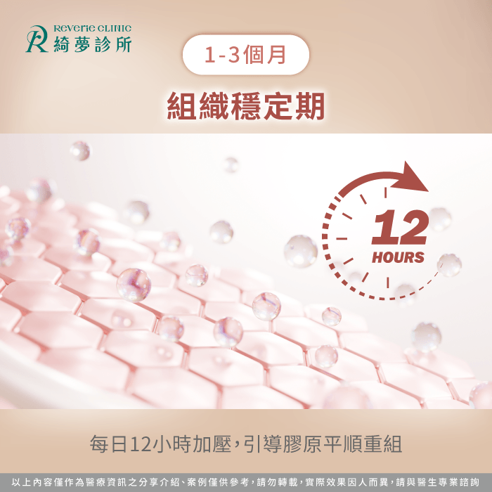 進入第二階段每日穿戴12小時能輔助纖維組織平順重組防止硬塊生成 組織穩定加壓期定型保養-抽脂塑身衣穿多久
