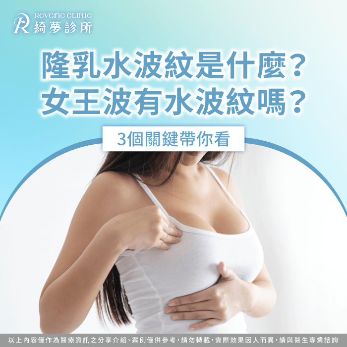 女王波水波紋-隆乳水波紋是什麼