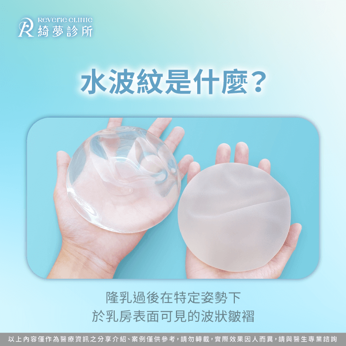 隆乳水波紋是什麼-隆乳水波紋是什麼