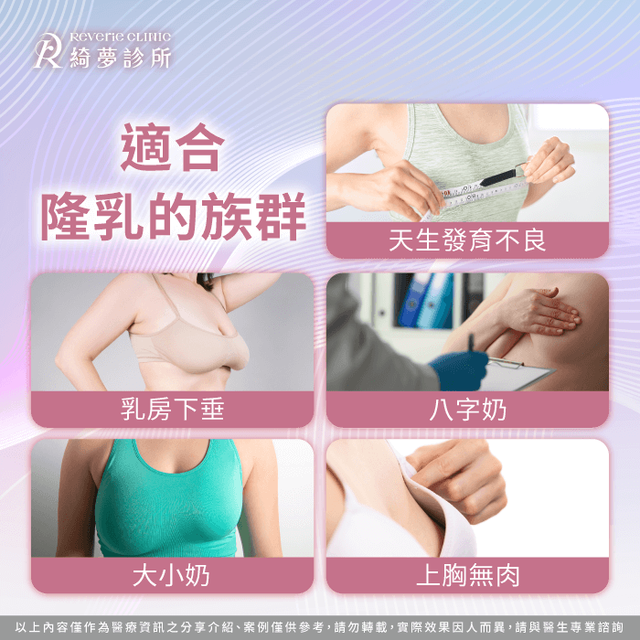 哪些人適合隆乳-女王波隆乳條件-隆乳條件
