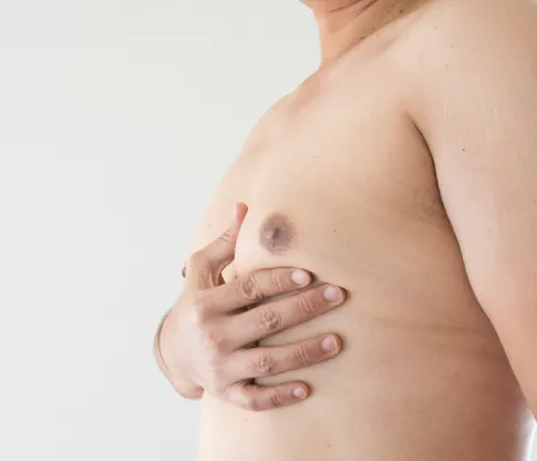 實際觸摸胸部、乳頭,感受是否有特殊觸感與結節 觸摸檢測-台北男性女乳症手術推薦