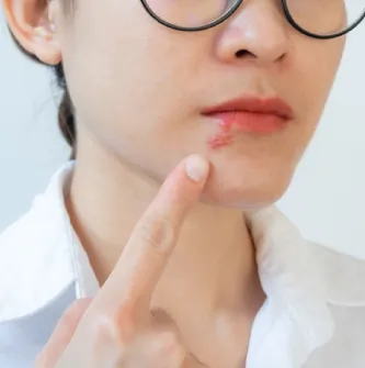 開放傷口-台北大安喬雅露推薦