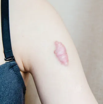 喬雅露應避免族群-台北喬雅露推薦