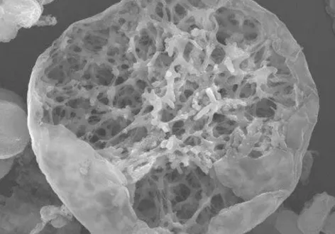 喬雅露專利噴灑技術產生的聚雙旋乳酸PDLLA晶球外觀飽滿、內部成均勻網格狀 喬雅露聚雙旋乳酸PDLLA晶球-台北大安喬雅露推薦