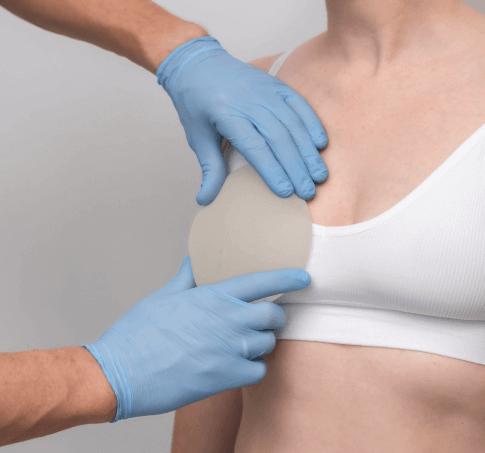 模擬胸型-台北珍珠波隆乳手術推薦